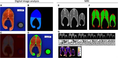 Genetic Parameters and Genome-Wide Association Studies of Quality Traits Characterised Using Imaging Technologies in Rainbow Trout, Oncorhynchus mykiss